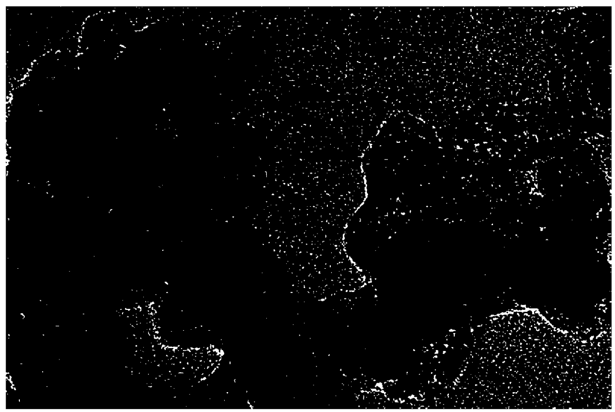 Preparation method of high-activity palladium carbon hydroxide based on microreactor