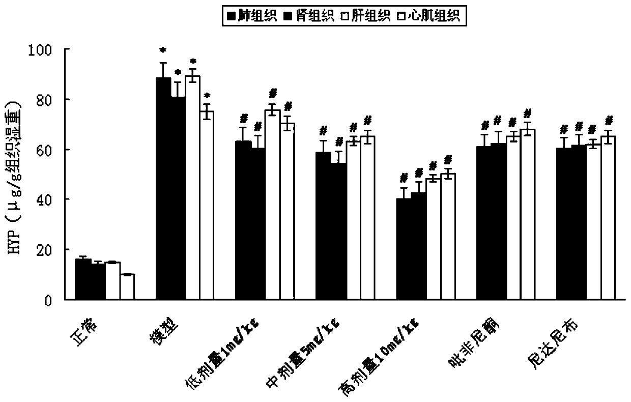 Eucheuma muricatum extract and application of Eucheuma muricatum extract in preparation of drugs for treatment of organ fibrosis