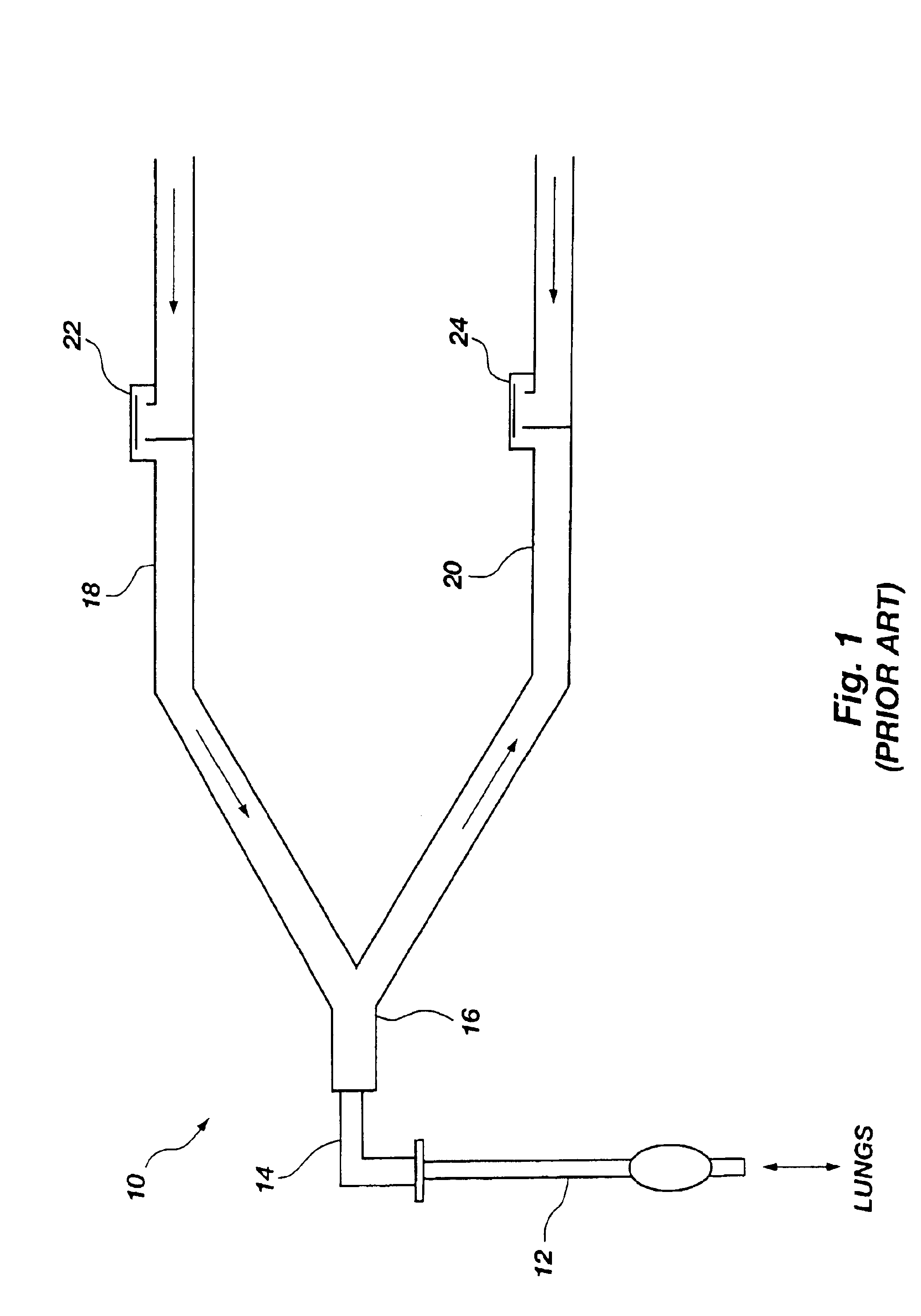 Apparatus and method for non-invasively measuring cardiac output