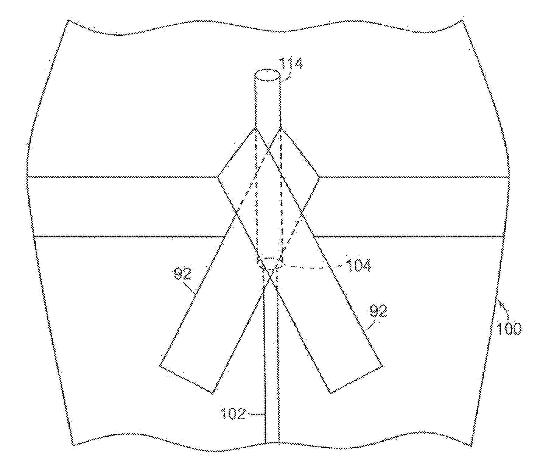 Adhesive layer arrangements and methods for securing medical tubing