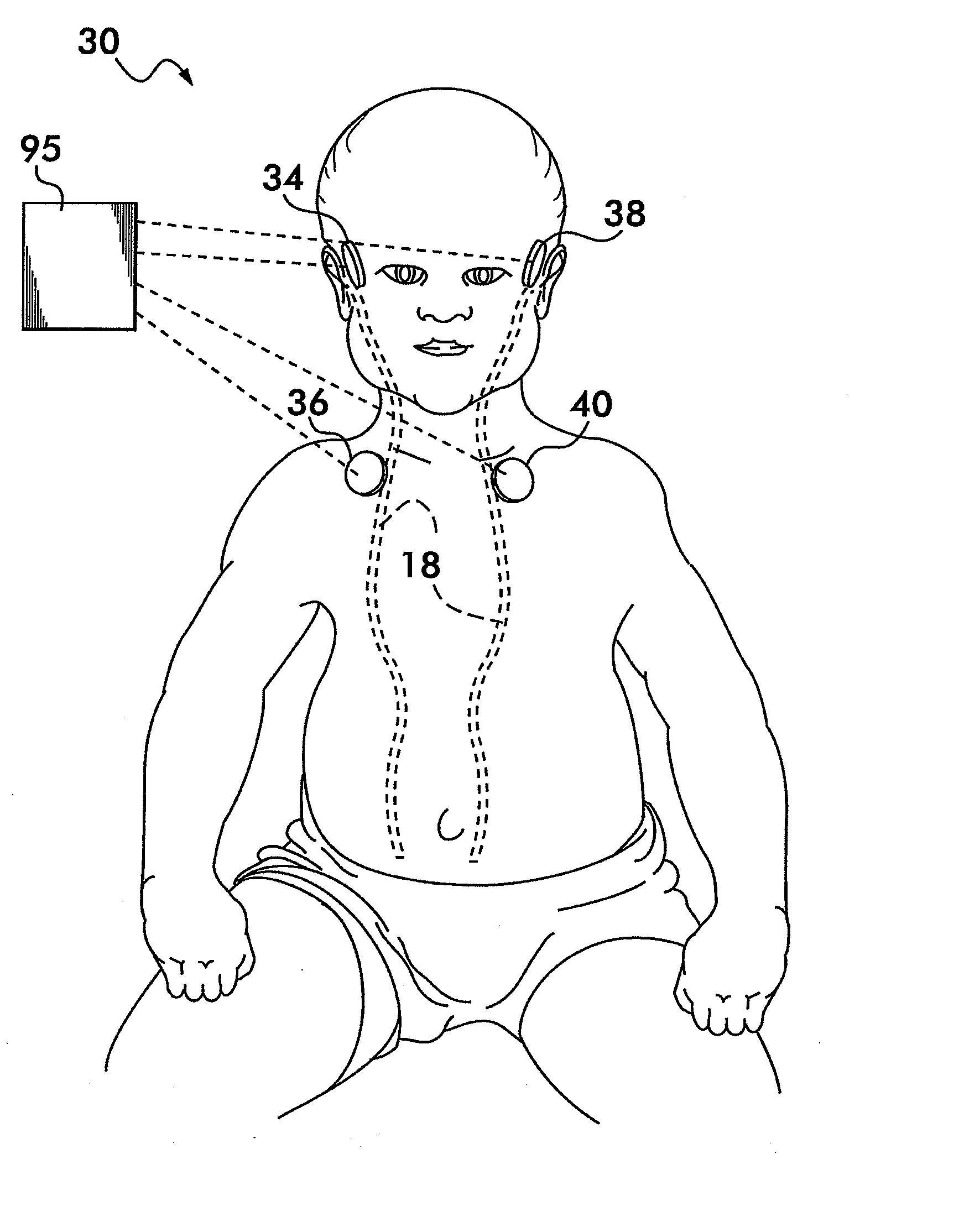 Cerebrospinal Fluid Evaluation Systems