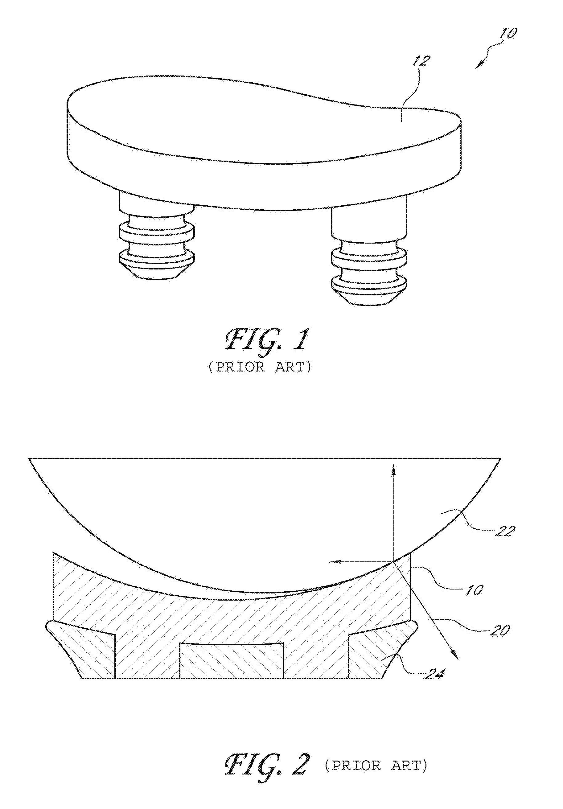 Glenoid component with improved fixation stability