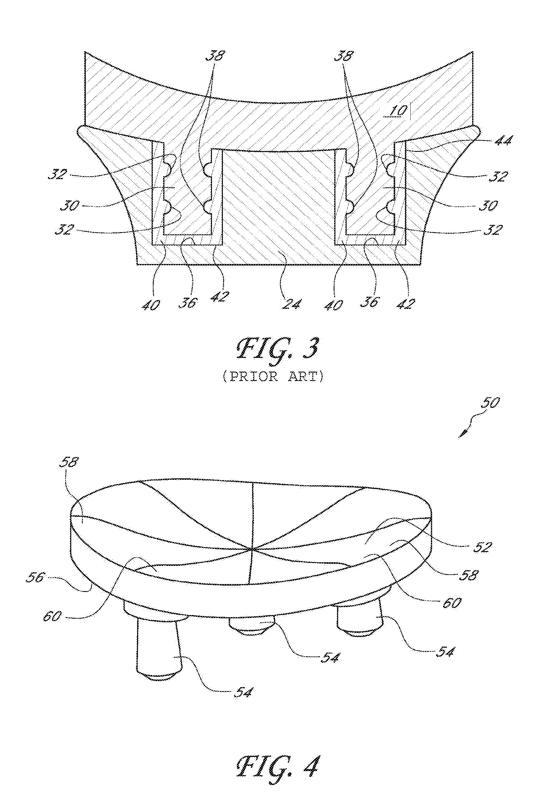 Glenoid component with improved fixation stability