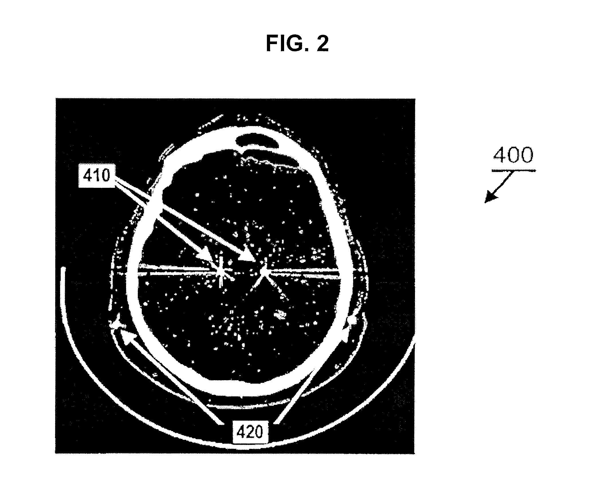 Method of determining the position of a deep brain stimulation electrode