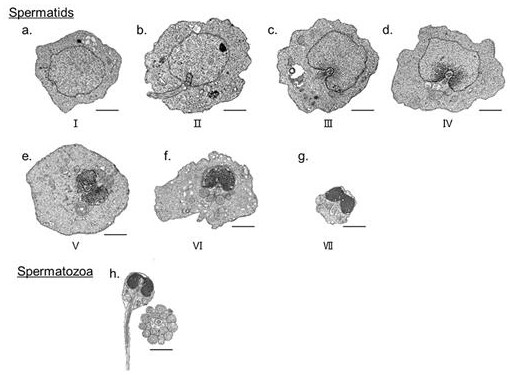 Cytological division method of sperm cell metamorphosis stage in turbot