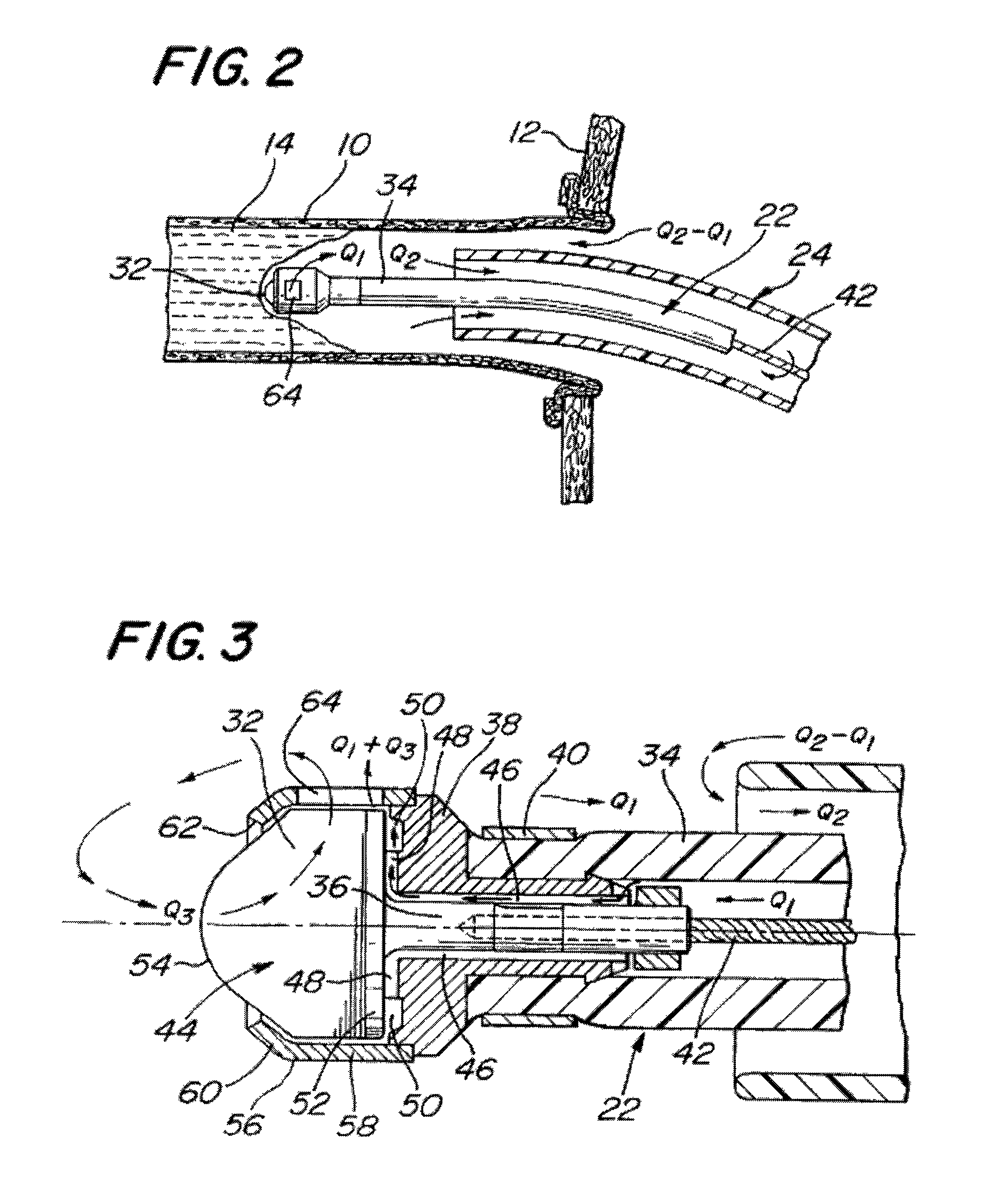 System and method of use for revascularizing stenotic bypass grafts and other blood vessels