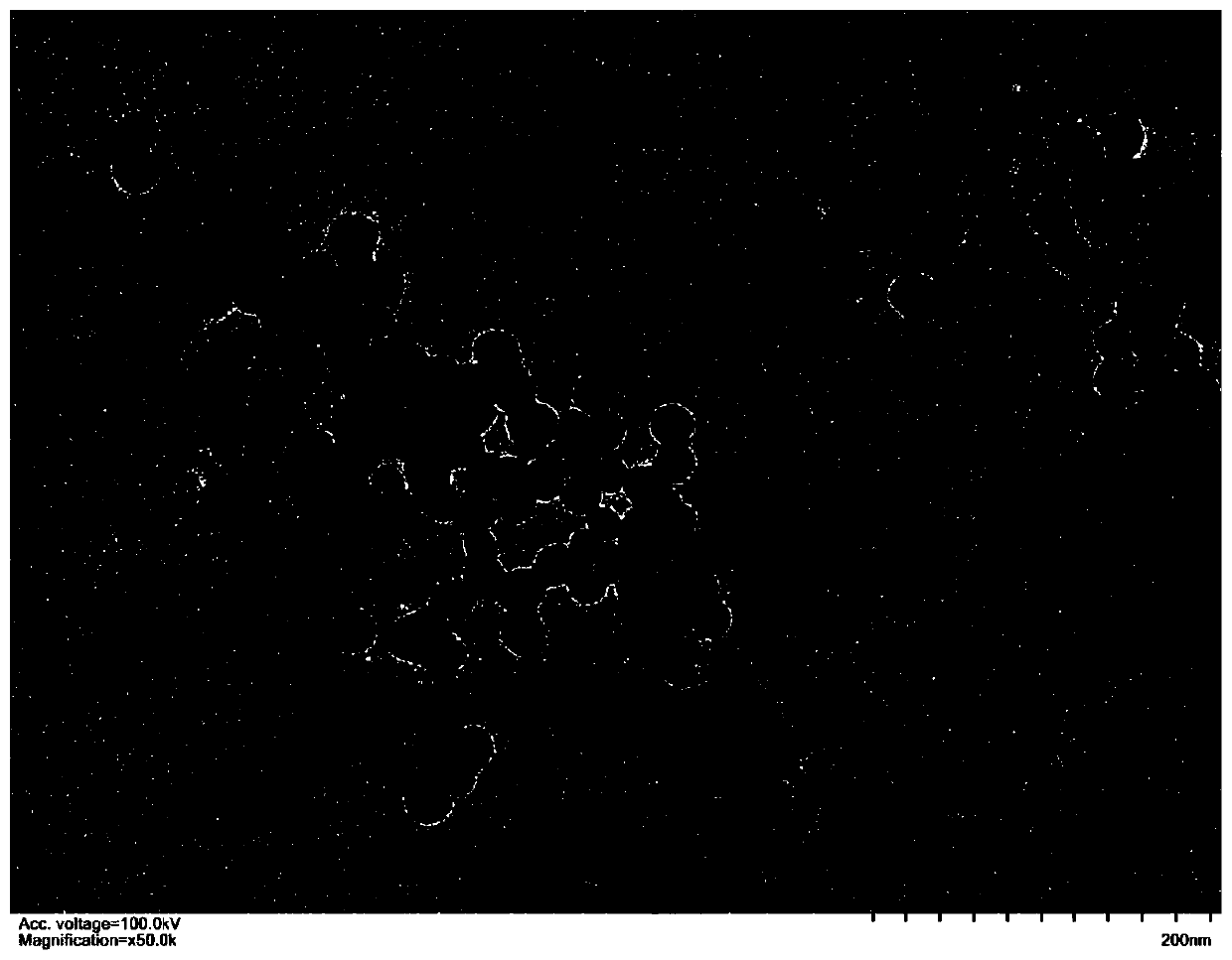 Positive charge nanogold coupling antibody wrapped by mesoporous silica as well as preparation method and application thereof