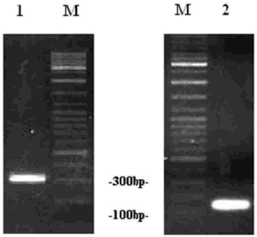 Recombinant human HNP gene liposome complex, preparation and use thereof