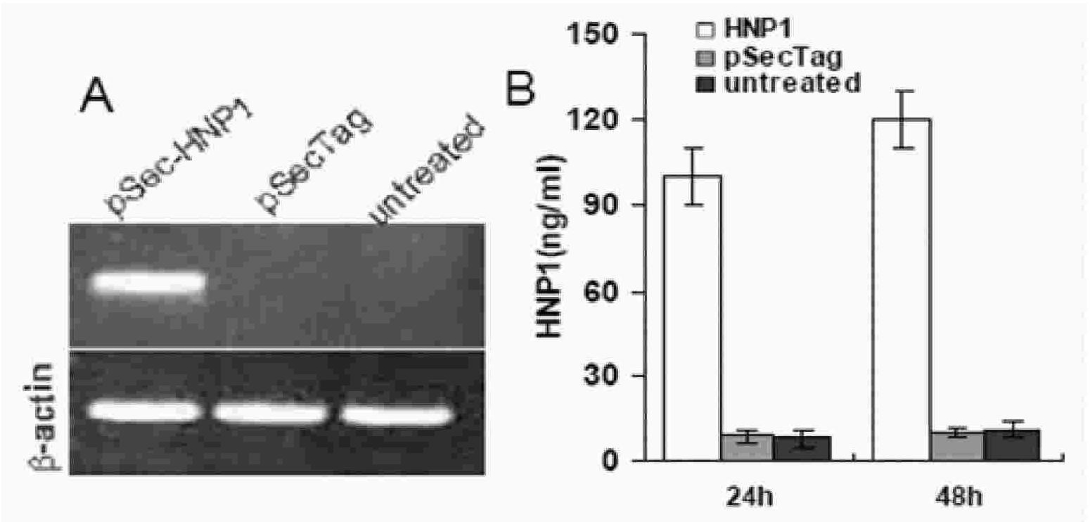 Recombinant human HNP gene liposome complex, preparation and use thereof