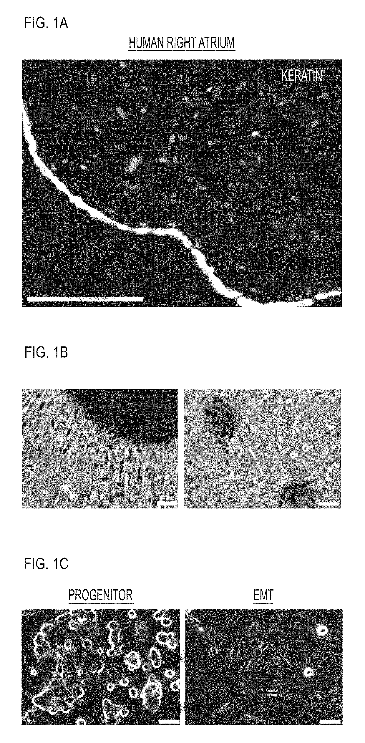 Compositions and Methods for Vascular Protection Against Reperfusion Injury After Myocardial Ischemia