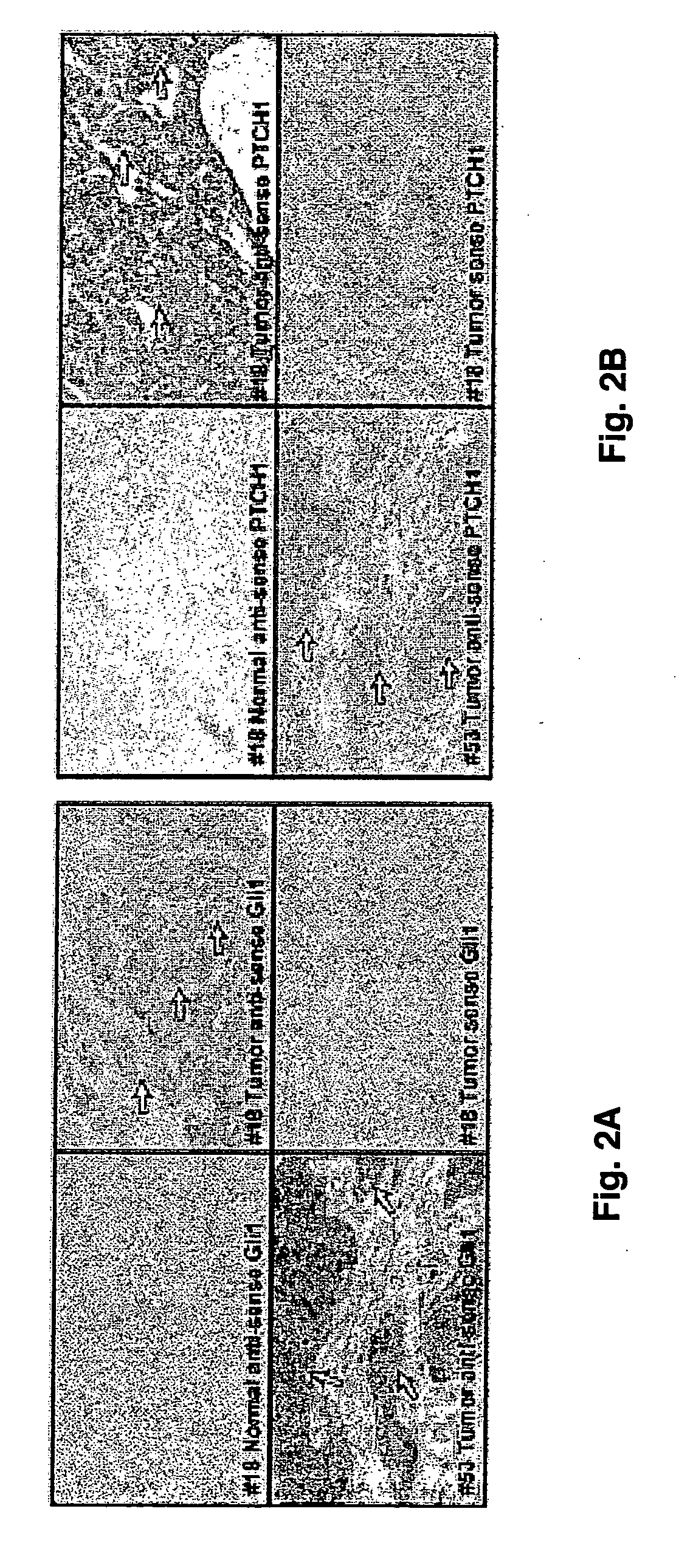 Regulation of the hedgehog signaling pathway and uses thereof