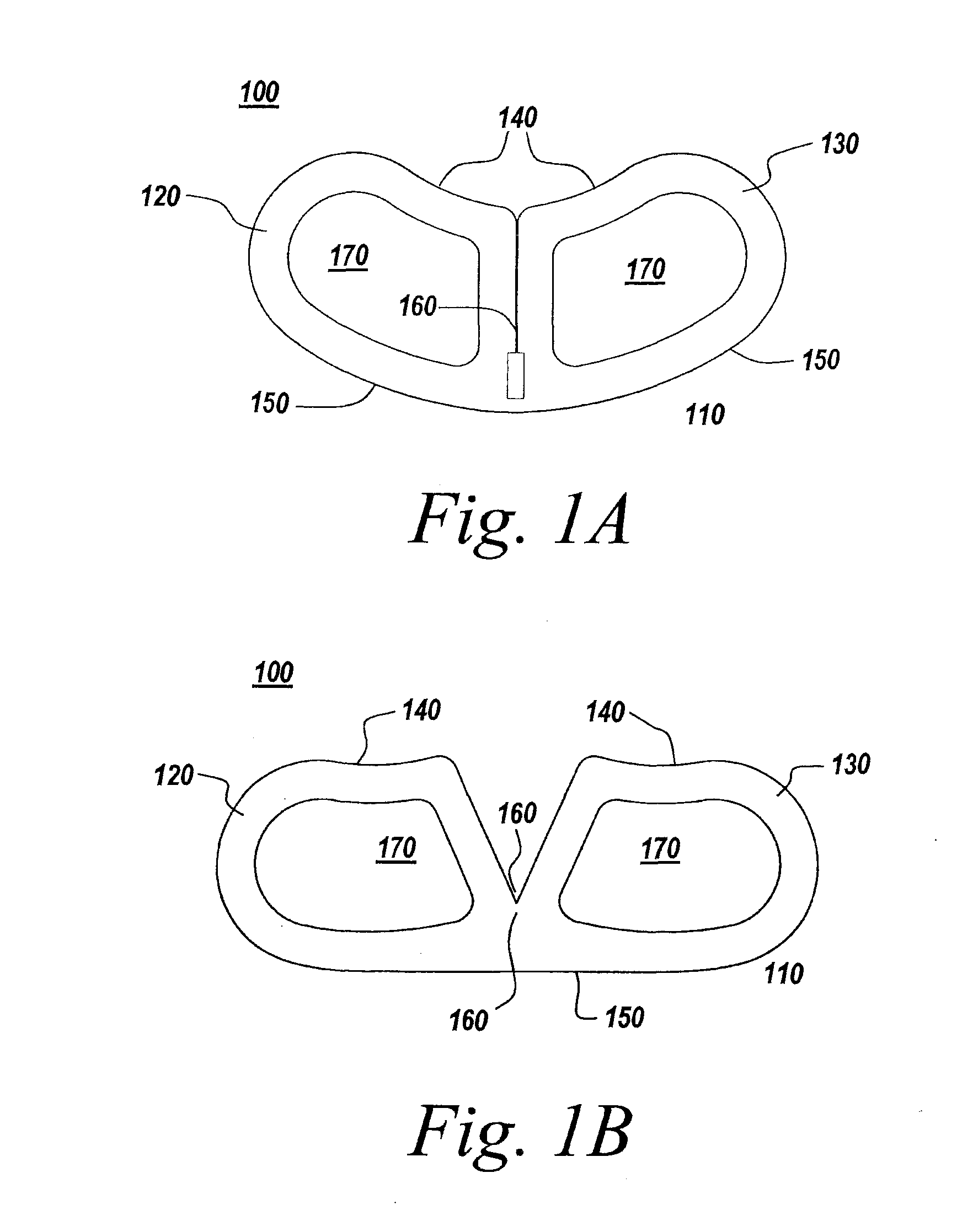 Spinal fusion implant