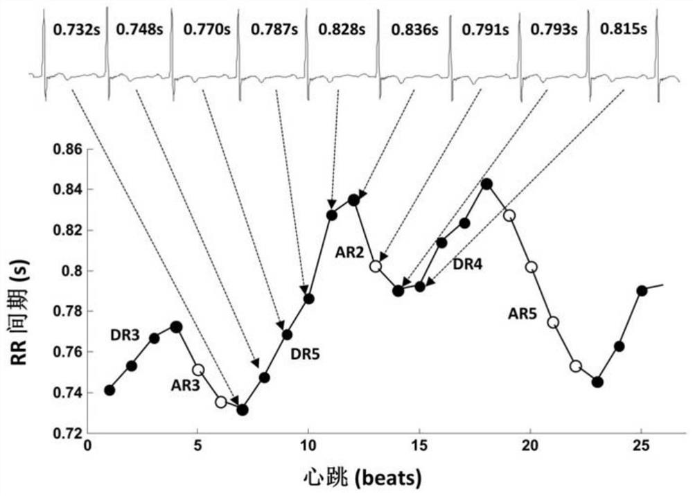 A method, device, and ECG monitoring device for judging autonomic nerve activity