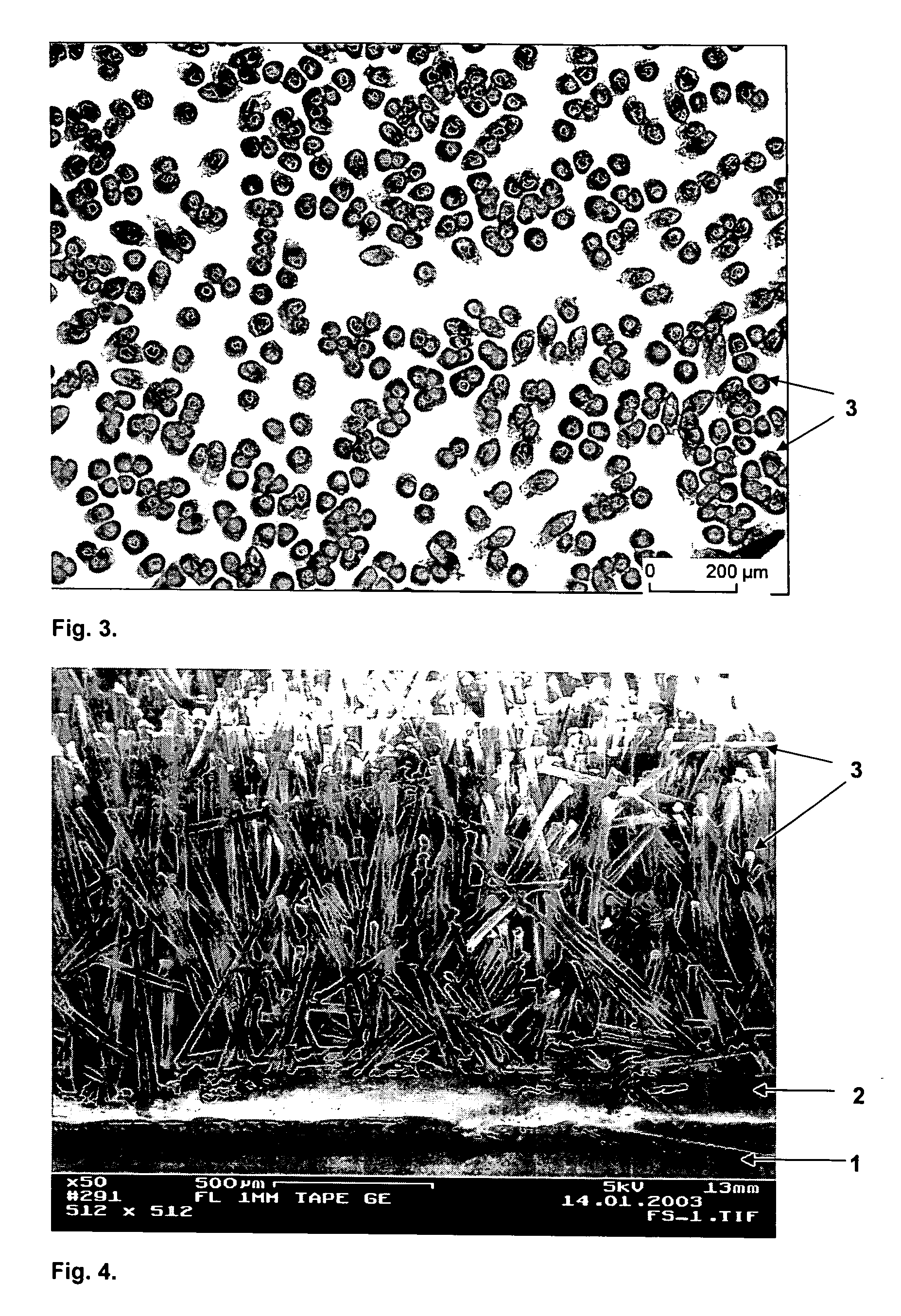 Support material for tissue engineering, for producing implants or implant materials, and an implant produced with the support material