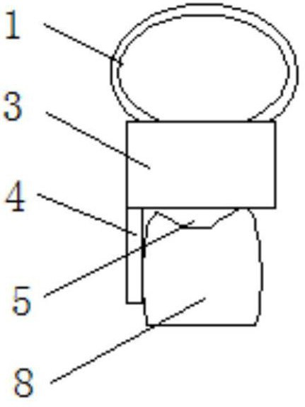 Fingerstall for temporomandibular joint reduction