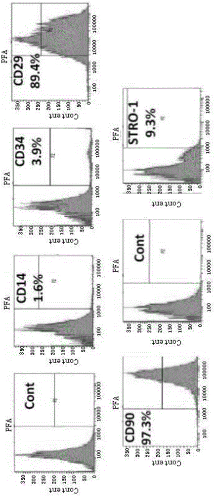 Method for analyzing periodontal ligament stem cell osteoblastic differentiation by application of gene chip
