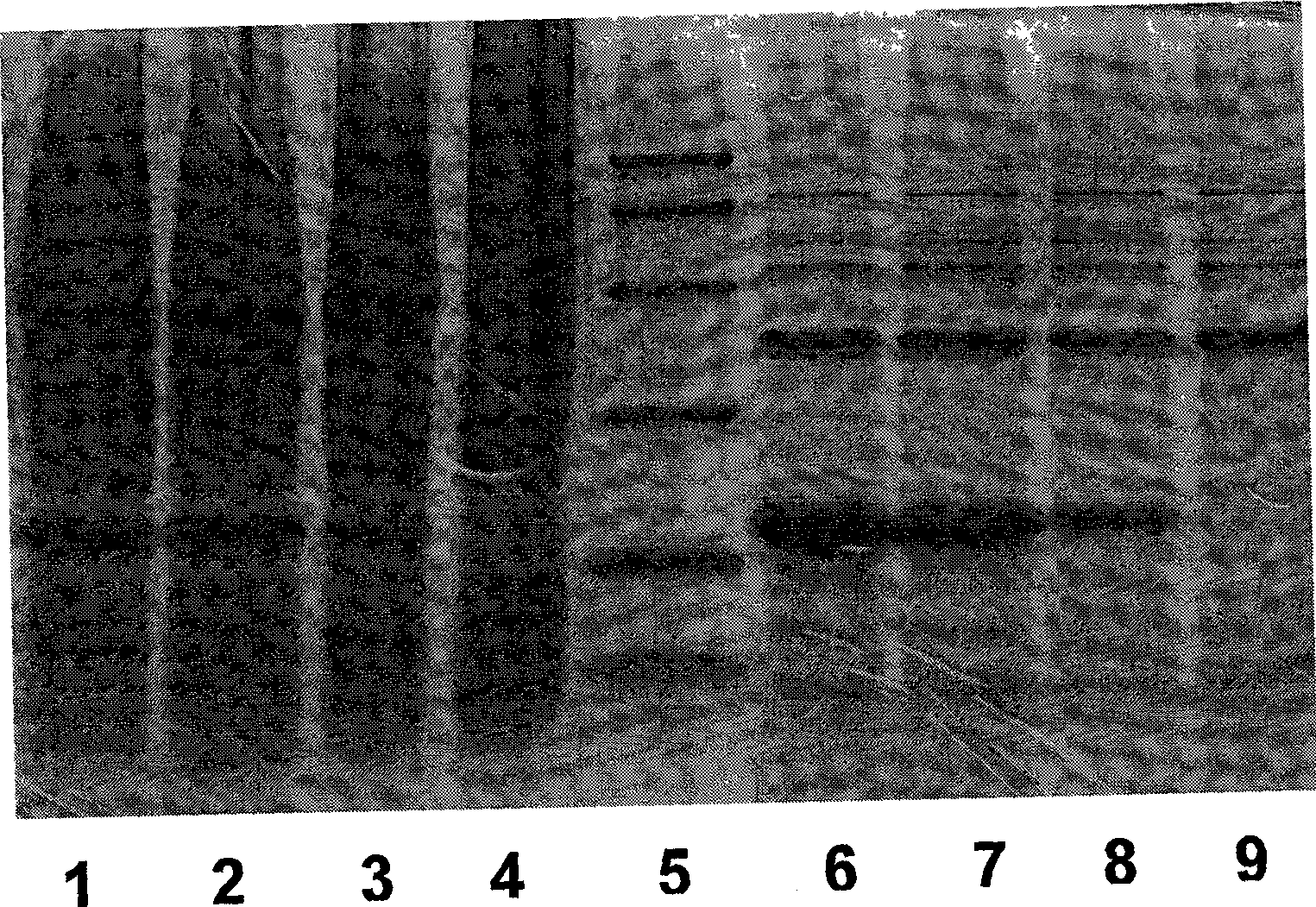 Method for preparing bitter melon polypeptide with function of reducing blood sugar bioactivity by gene engineering and application