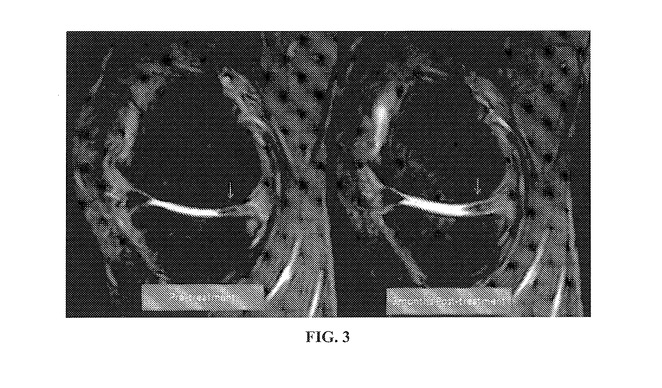 Methods and compositions for the treatment, prevention, and alleviation of bone and cartilage diseases or injuries and hair loss
