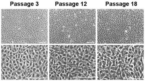 Cartilage progenitor cell culture medium and preparation method and application thereof