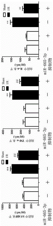 Application of miR-665-3p inhibitor to preparation of medicine for preventing and treating ischemia-reperfusion injuries