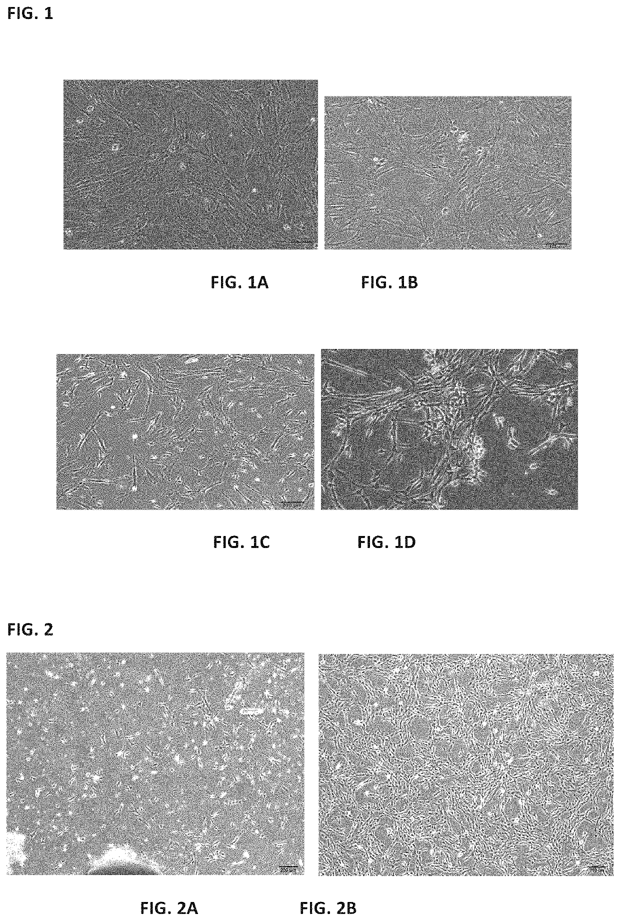 Method for separating and culturing mesenchymal stem cells from Wharton's jelly tissue of umbilical cord