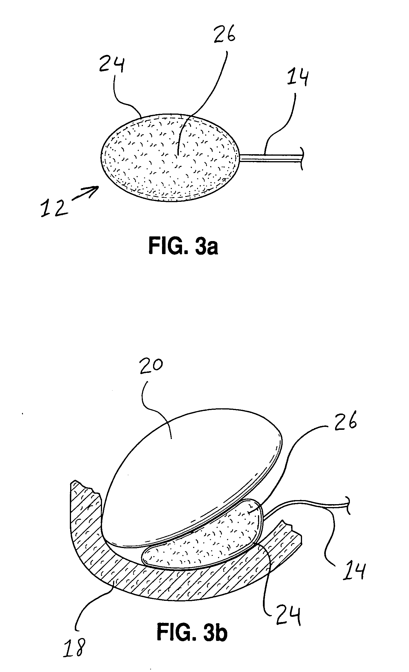Systems and methods for determining pressure and spacing relating to anatomical structures