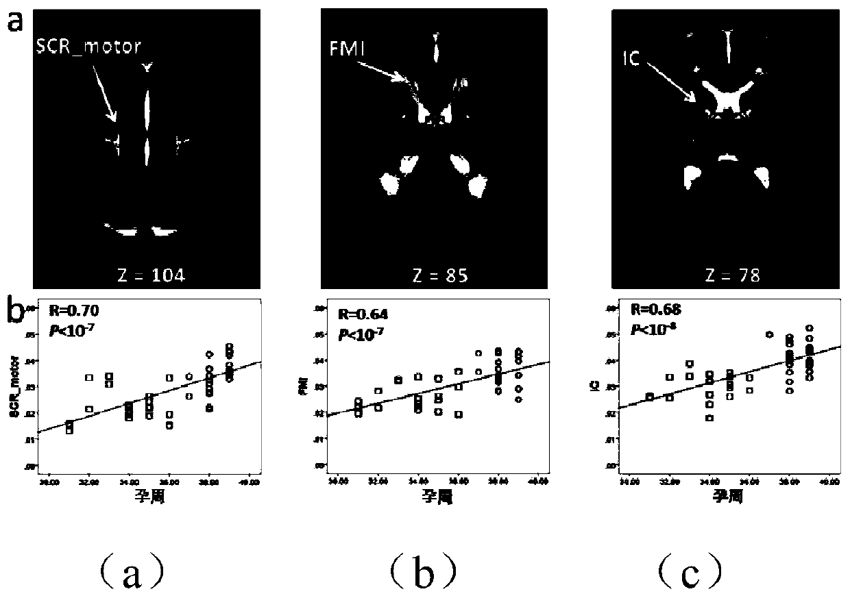 Newborn brain development quantitative analysis method based on magnetic resonance diffusion tensor brain image