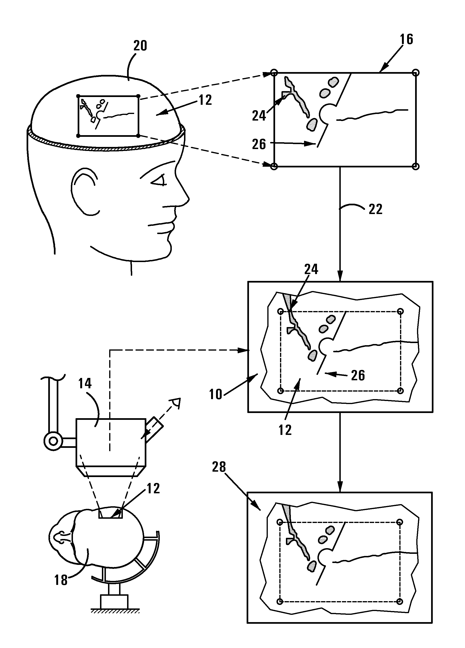 Method of and system for overlaying nbs functional data on a live image of a brain
