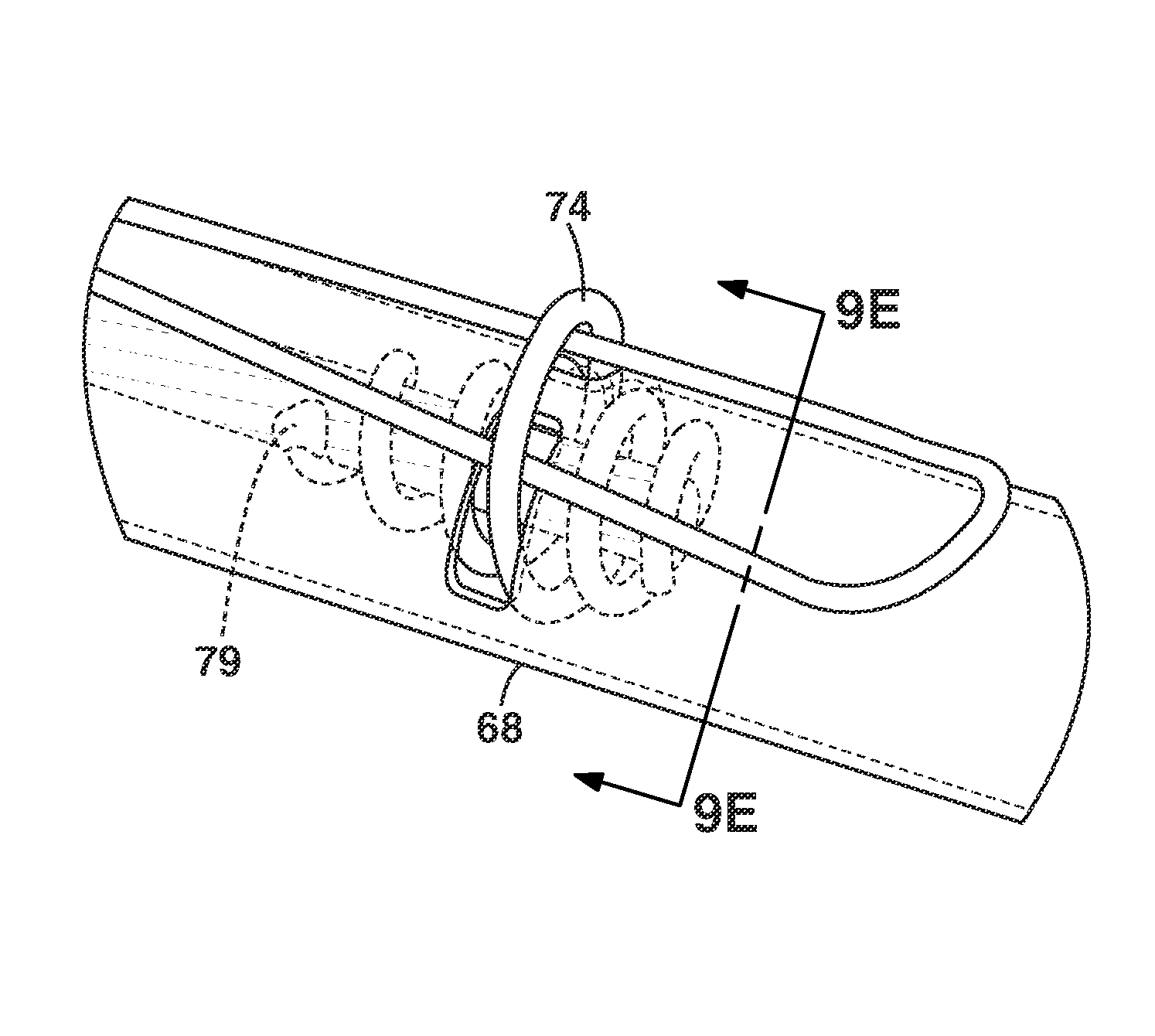 Delivery system for implantable medical device