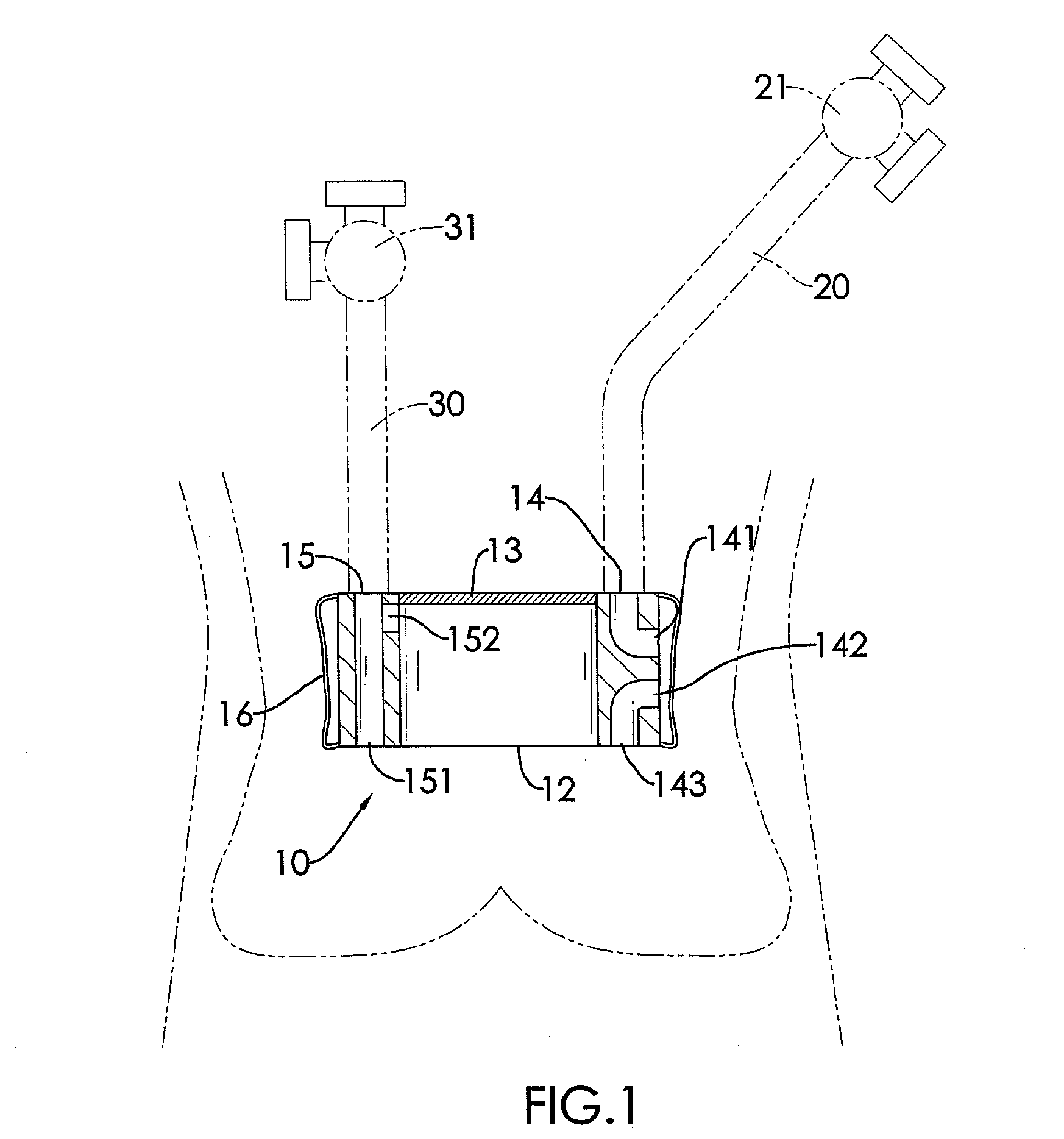 Examining device for examining an aortic valve and a pulmonary valve competency