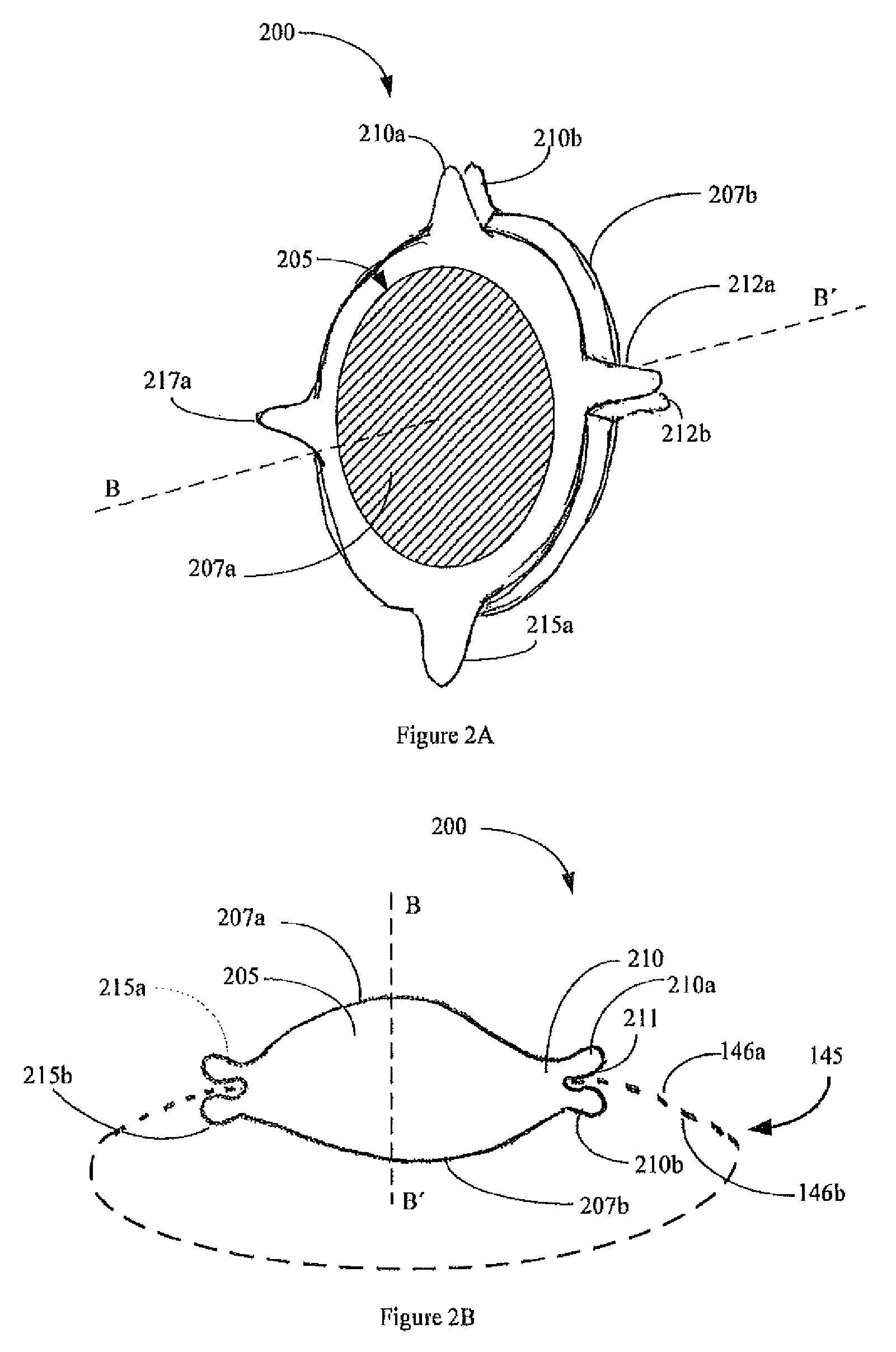 Micro-incision IOL and positioning of the IOL in the eye