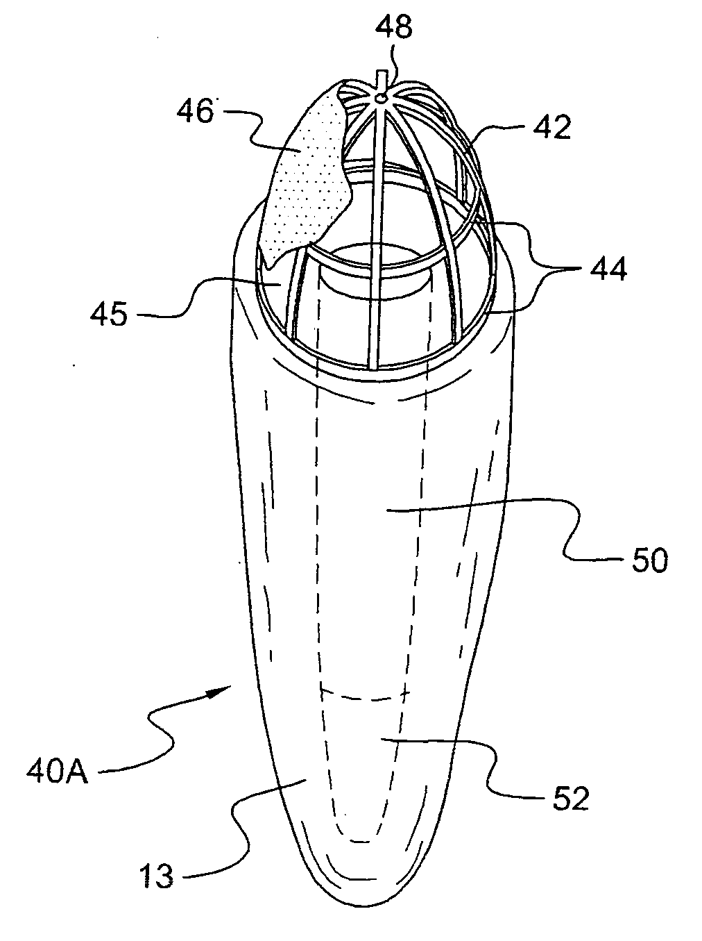 Force redirecting dental core system