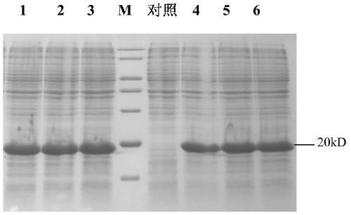 A kind of preparation method of high-purity recombinant human brain natriuretic peptide