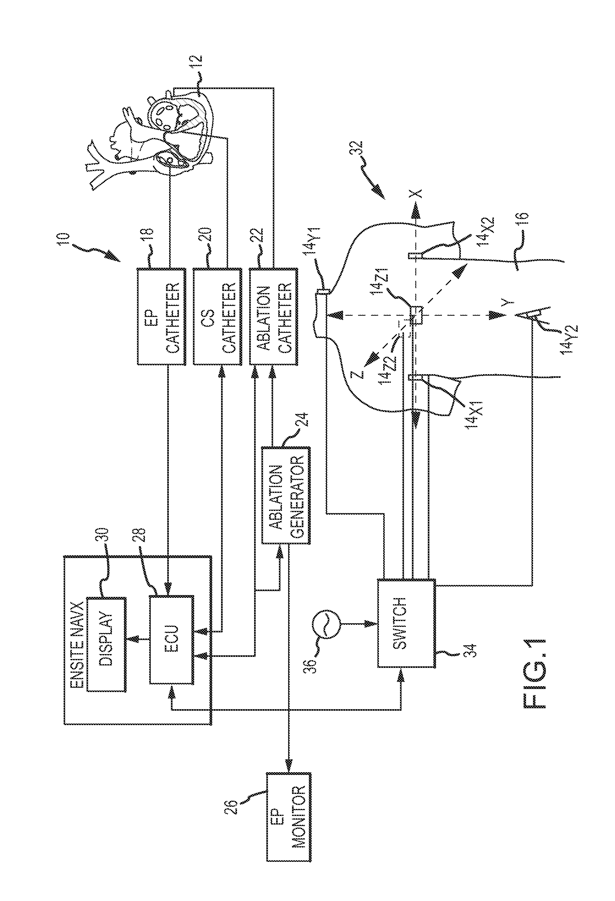 System and method for treating arrhythmias in the heart using information obtained from heart wall motion