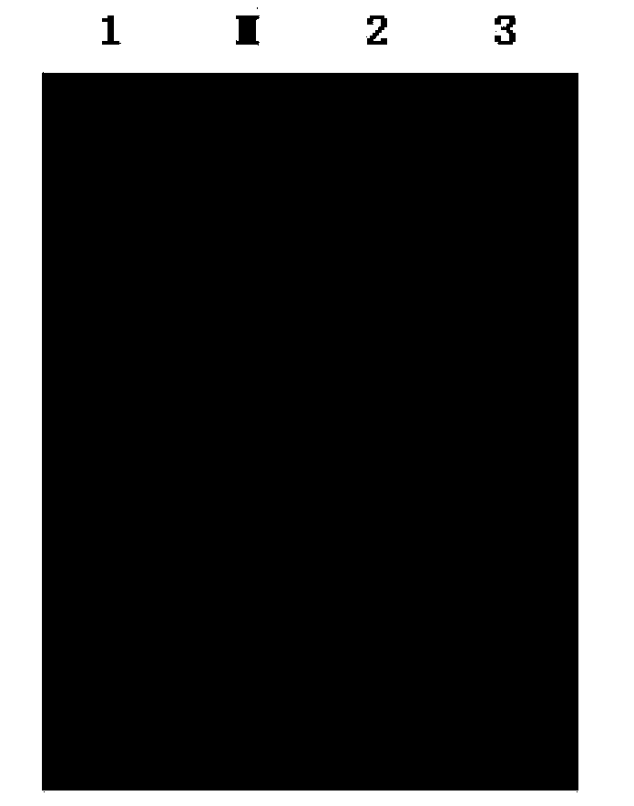 Detection reagent kit and detection method of aeromonas bacteria