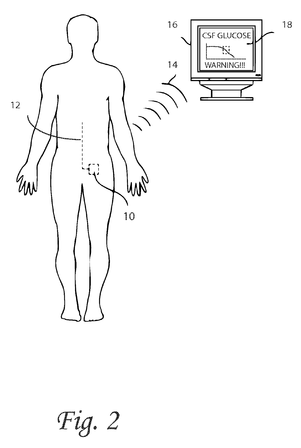 Systems and methods for lumbar cerebrospinal fluid access and treatment