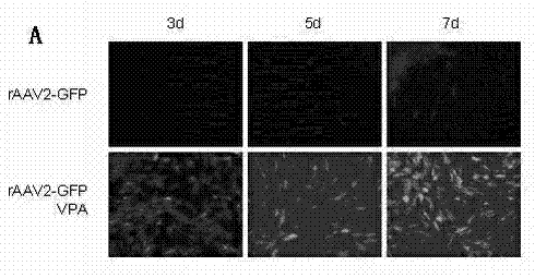 Medicinal composition for protecting optic nerve of glaucoma and preparation method thereof