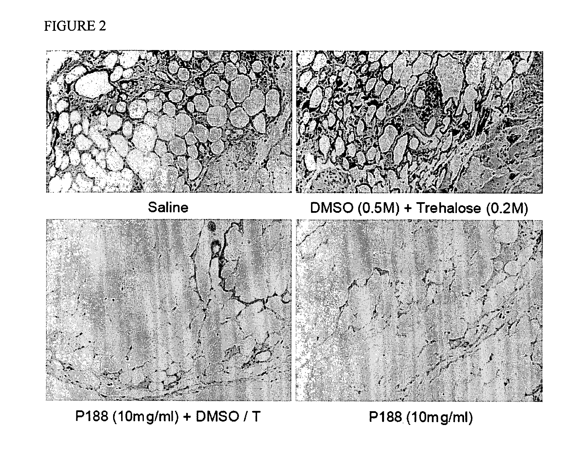 Methods and compositions for improving the viability of cryopreserved cells