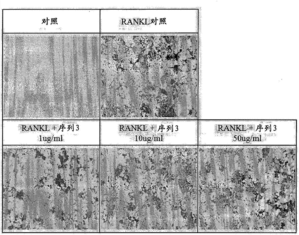 Peptide having osteoclast differentiation and activation inhibition, and use of same