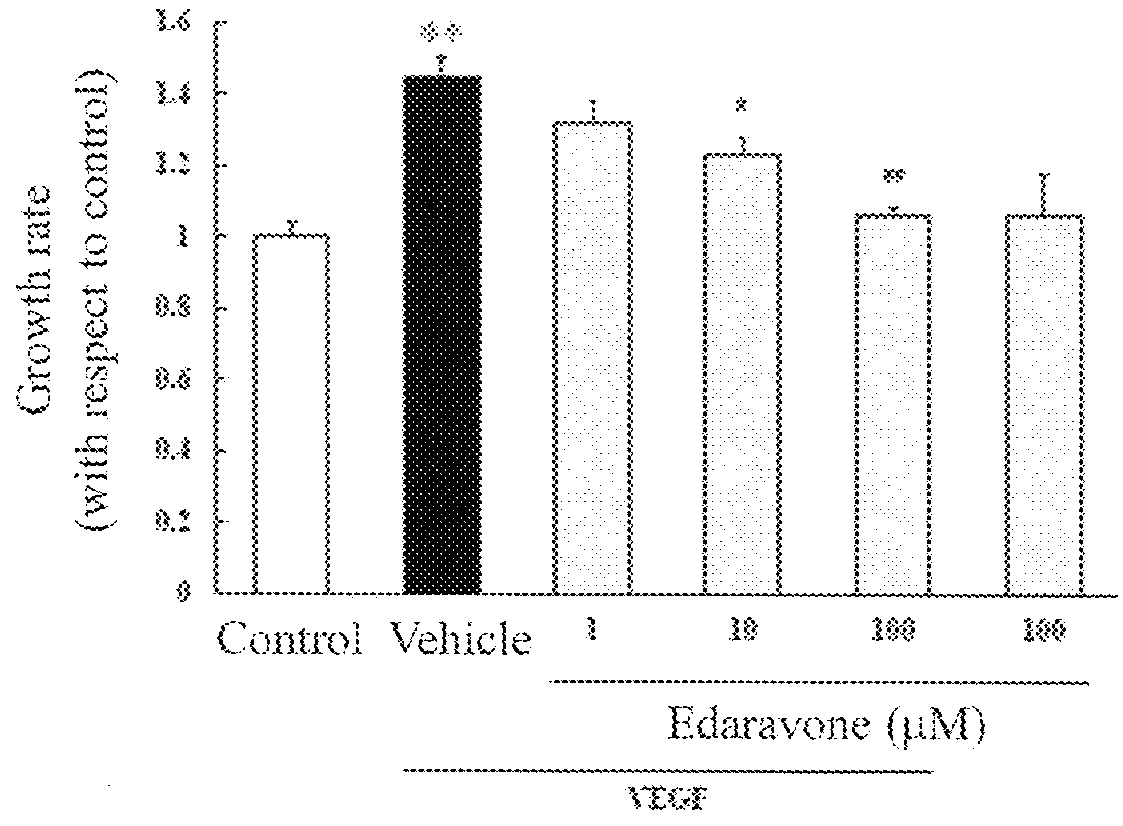 Agent for preventing and/or treating ophthalmologic diseases