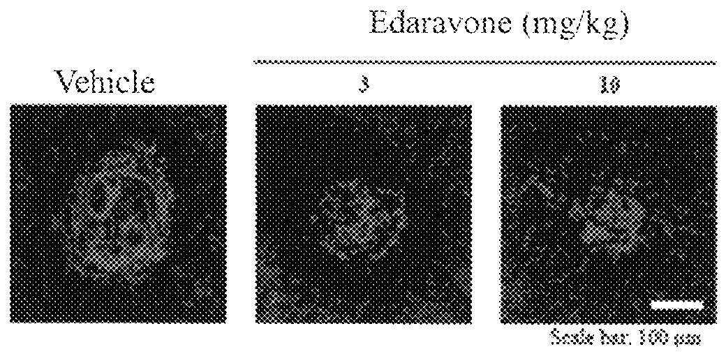 Agent for preventing and/or treating ophthalmologic diseases