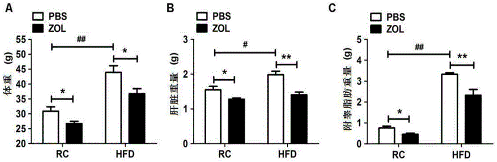 Application of zoledronic acid in preparation of drugs for treating fatty liver diseases