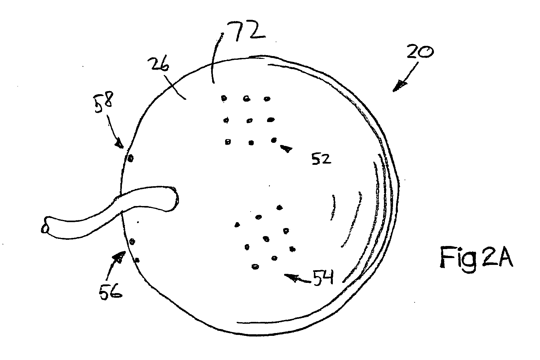 System and method for treating connective tissue