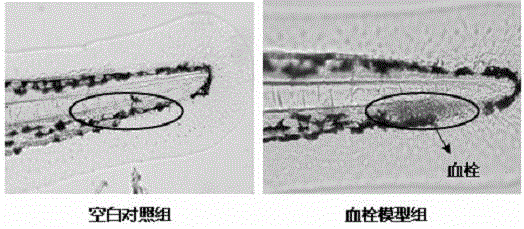 Method for establishing zebra fish thrombosis model