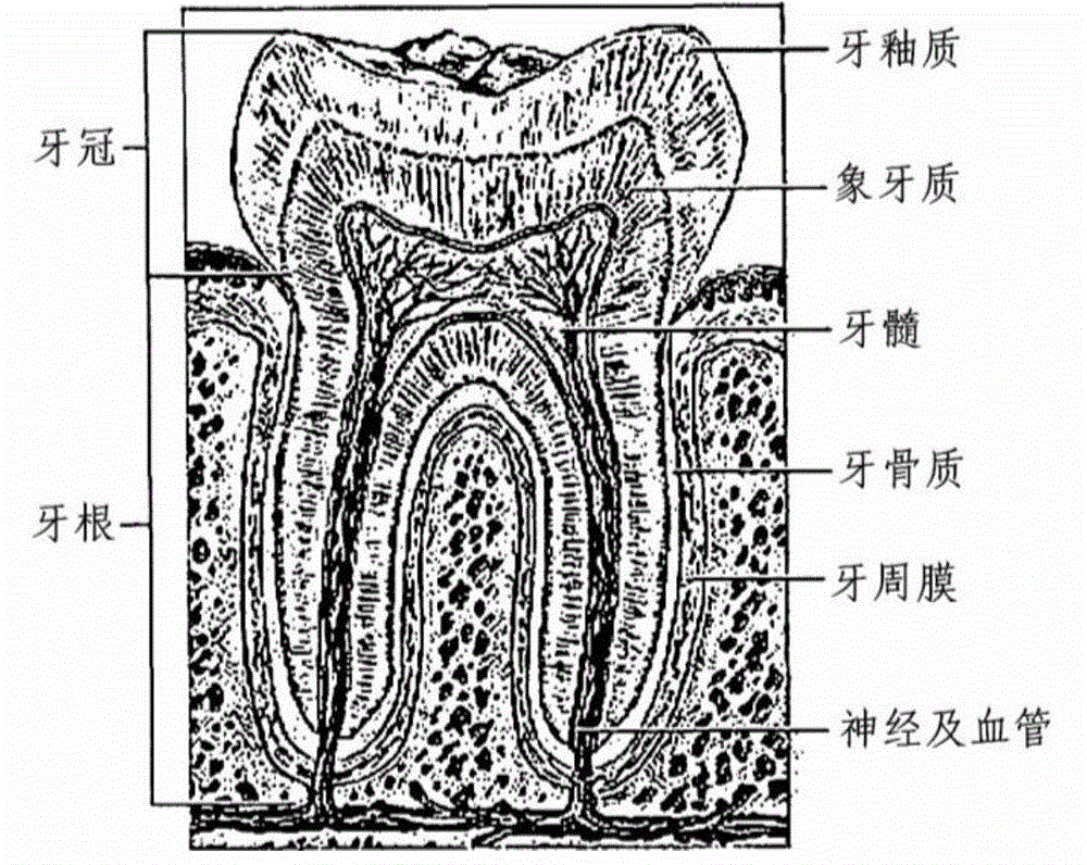 Method for processing bone graft material using teeth, and bone graft material processed thereby