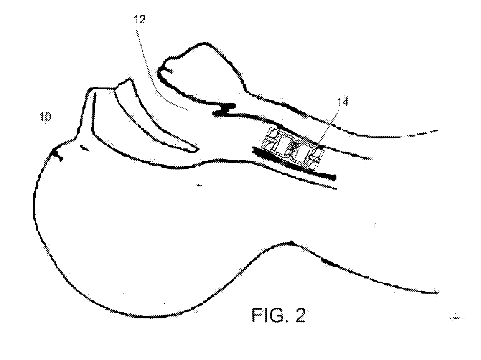 Apparatus for infection control