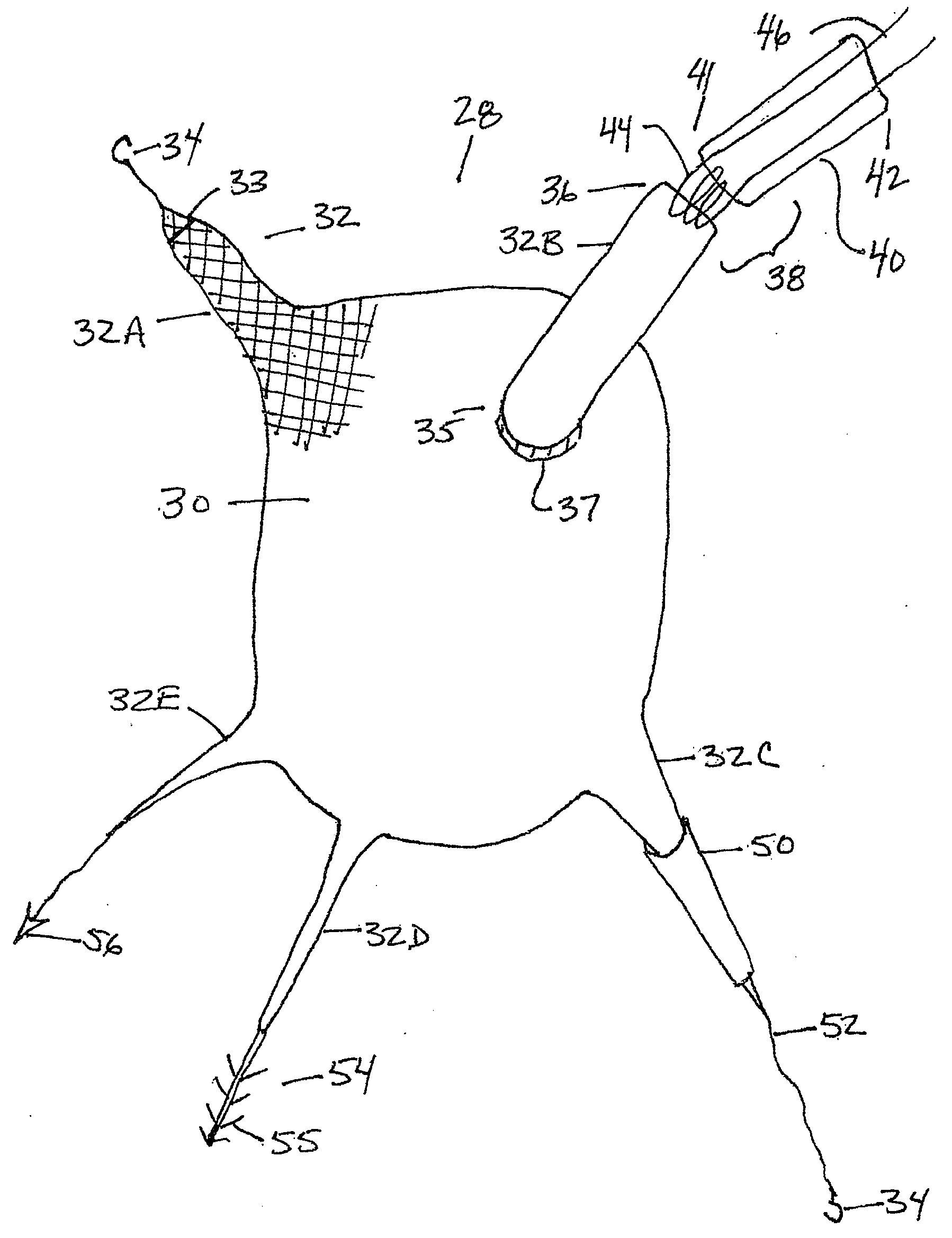 Methods and Apparatus for Treating Pelvic Floor Prolapse