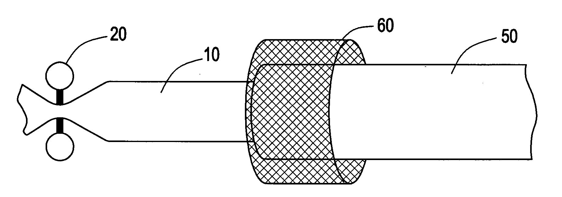Method and system of attaching vessels to grafts