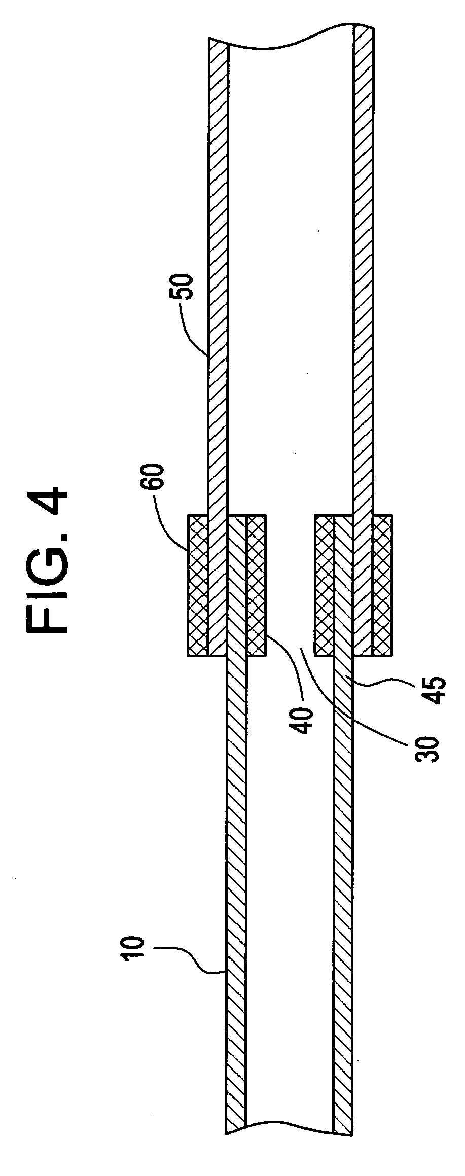 Method and system of attaching vessels to grafts