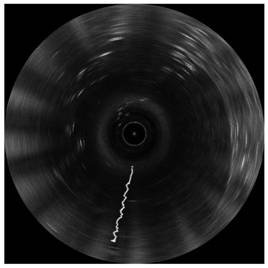 Sonar target detection method and system based on time history accumulated images